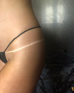 airbrush potamnjivanje tijela